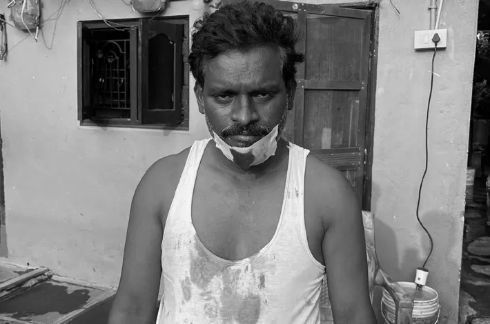 నమస్తే న్యూస్ రిపోర్టర్‌కు తీవ్ర గాయాలు