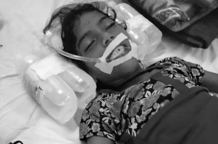పాము కాటుకు గురై ఇంటర్ విద్యార్థిని మృతి