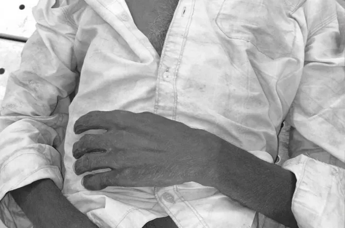 అనారోగ్యంతో వ్యక్తి మృతి