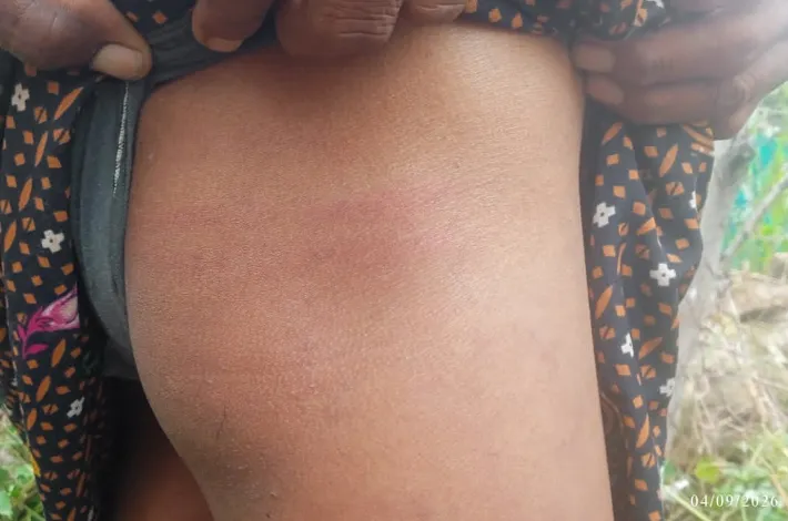 ఆదివాసిన అధికారిపై అట్రాసిటీ కేసు నమోదు చేయాలి