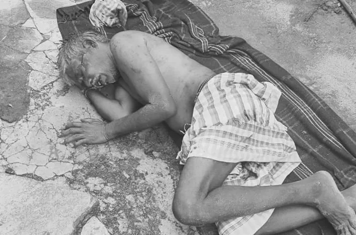 గుండ్లపల్లి లో 11 కెవి హై టెన్షన్ వైరుతో వృద్ధునికి ప్రమాదం!!