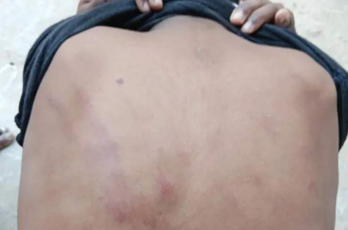 పసిపిల్లవాని చితకబాదిన ఉపాధ్యాయుడు