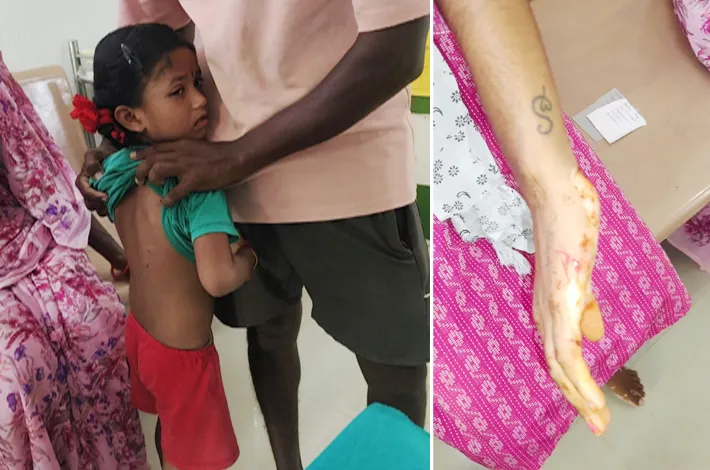 కుక్కల దాడులతో భయాందోళన!
